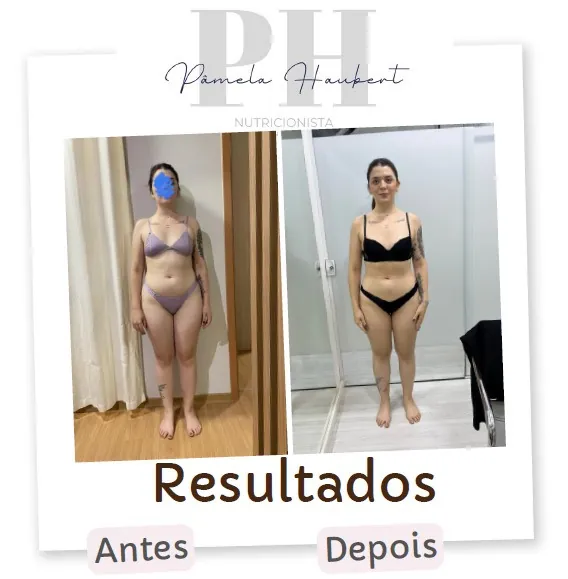 Antes e depois de paciente acompanhada pela Pâmela Haubert