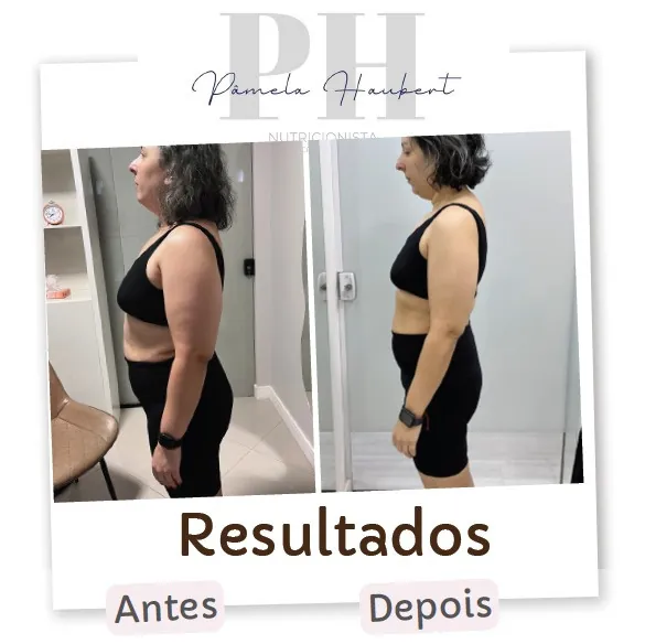 Antes e depois de paciente acompanhada pela Pâmela Haubert